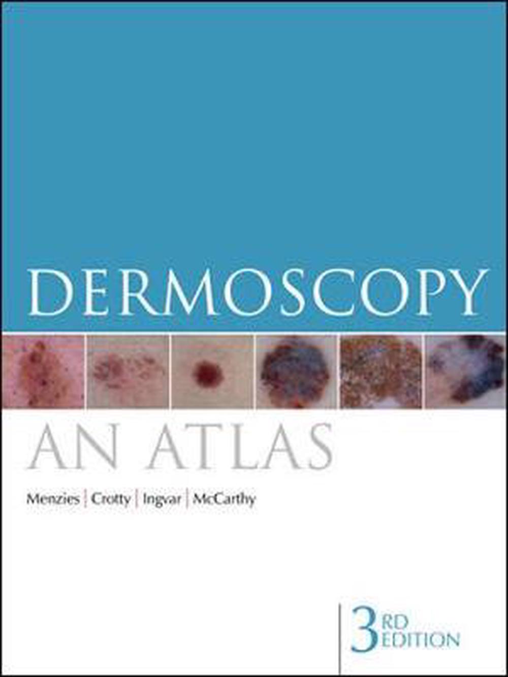 Dermoscopy: An Atlas, 9780070159099