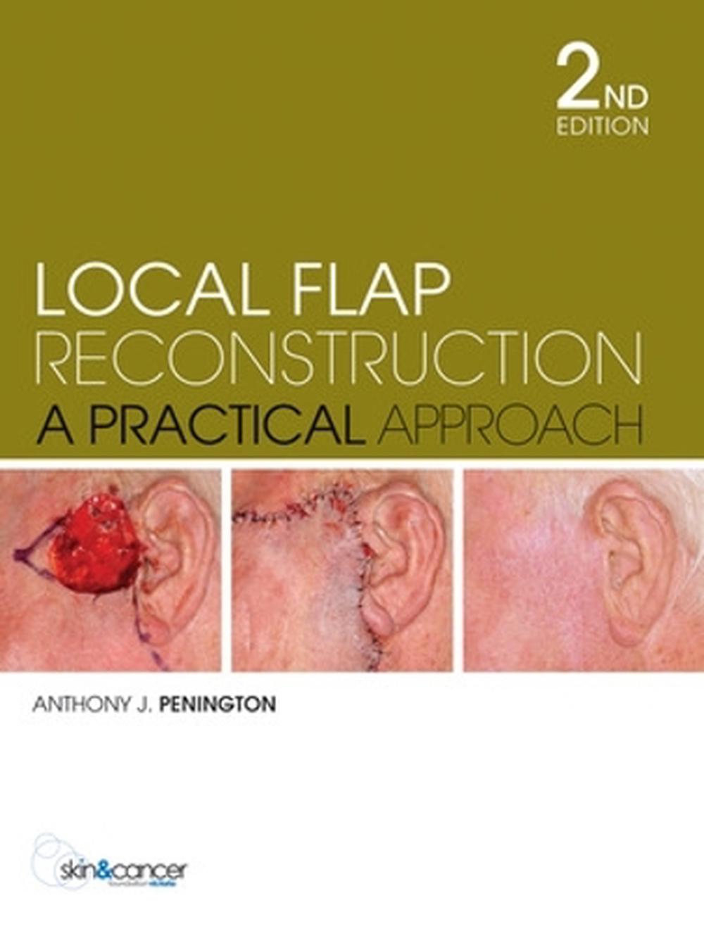 at　Hardcover,　Reconstruction　Local　Flap　The　online　by　Anthony　Buy　Penington,　9780070278387　Nile