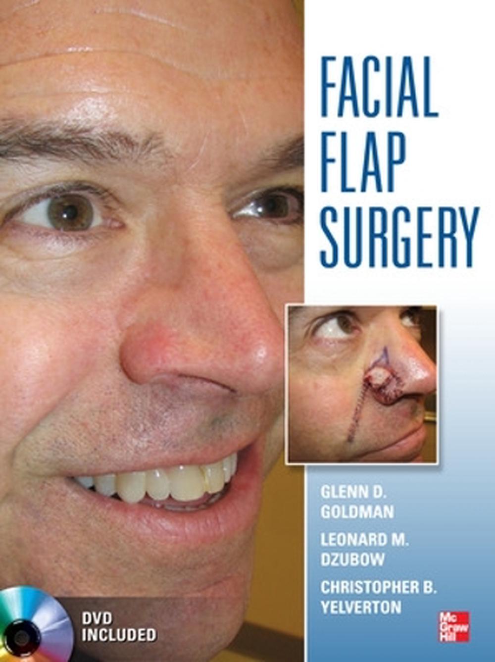 Facial Flaps Surgery, 9780071749251