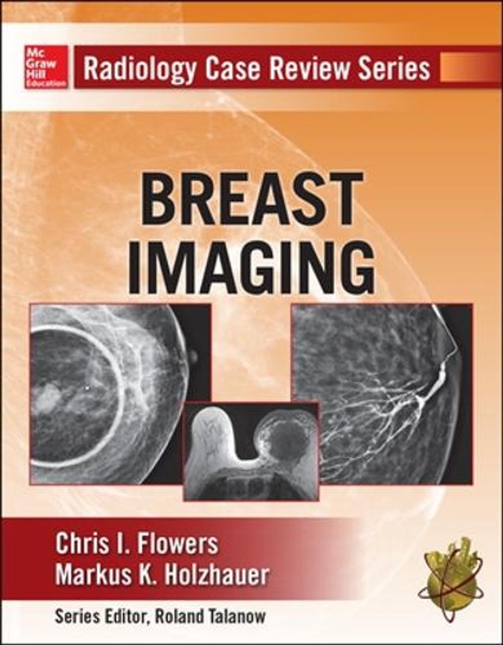 Radiology Case Review Series: Breast Imaging by Chris Flowers - ISBN: 9780071787192