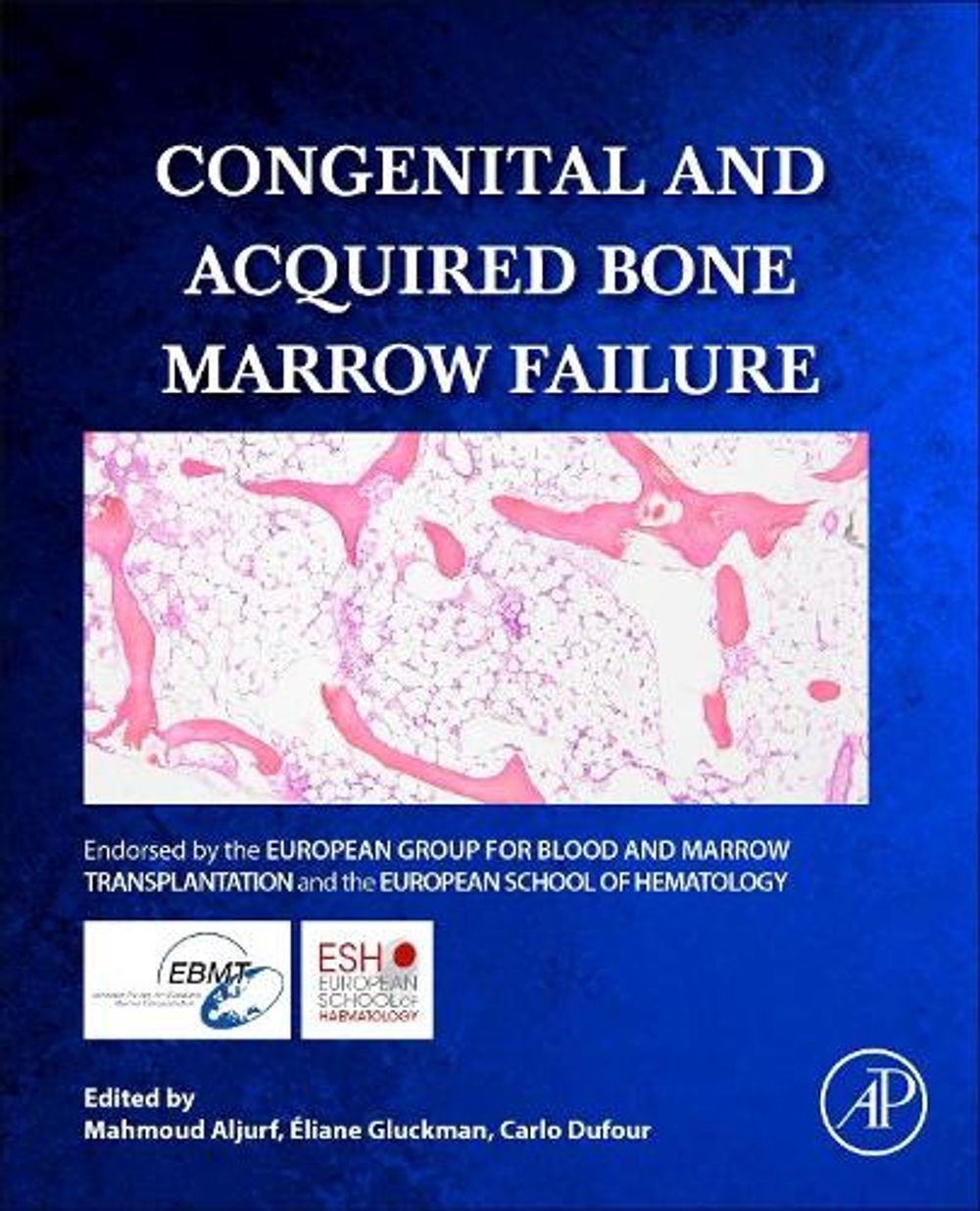 Congenital and Acquired Bone Marrow Failure by Eliane Gluckman - ISBN: 9780128041529