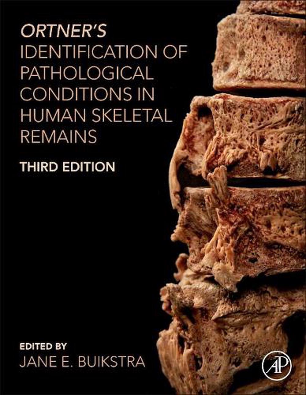 Ortner's Identification of Pathological Conditions in Human Skeletal Remains, 3rd Edition, 9780128097380