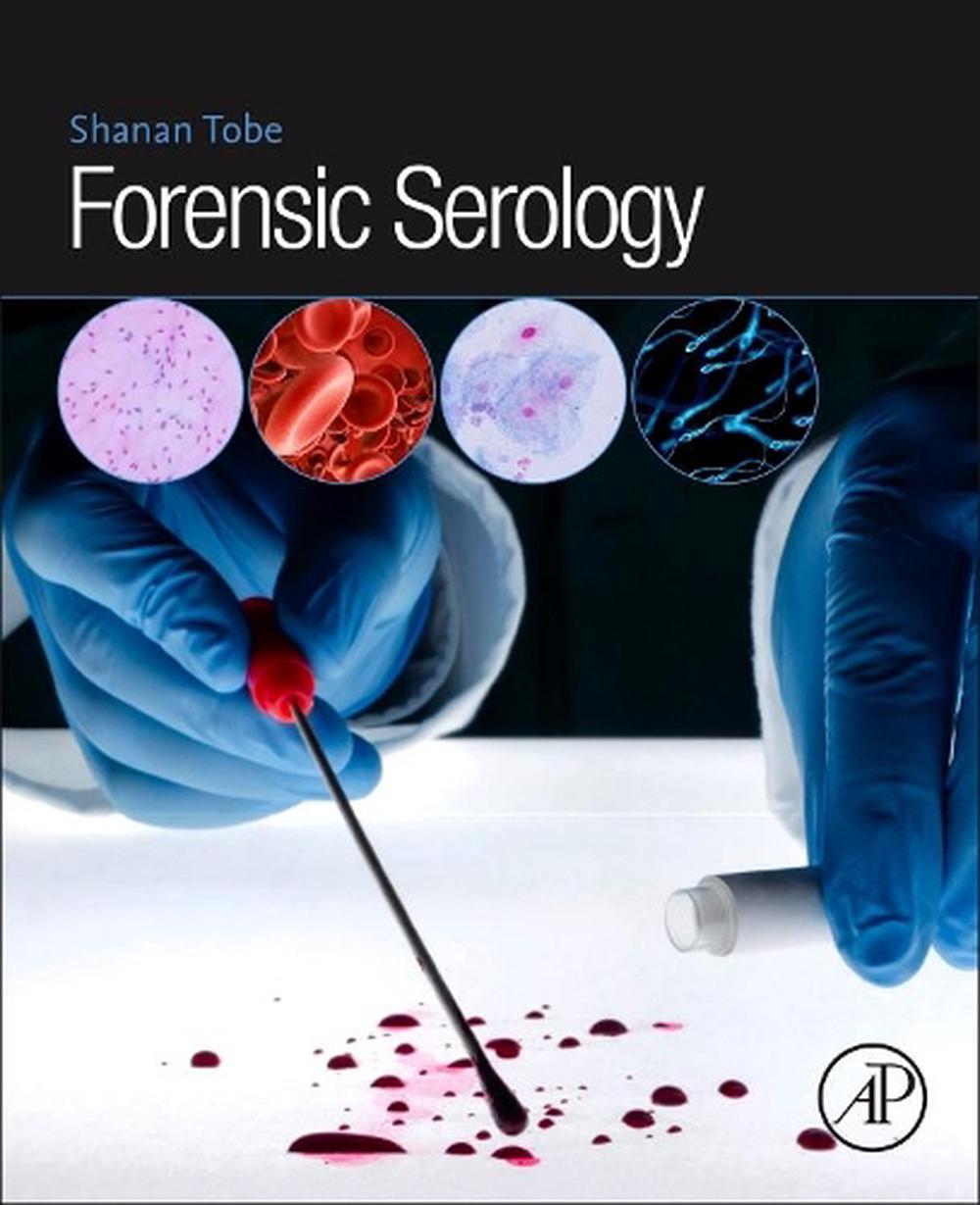 Forensic Serology, 9780128129685