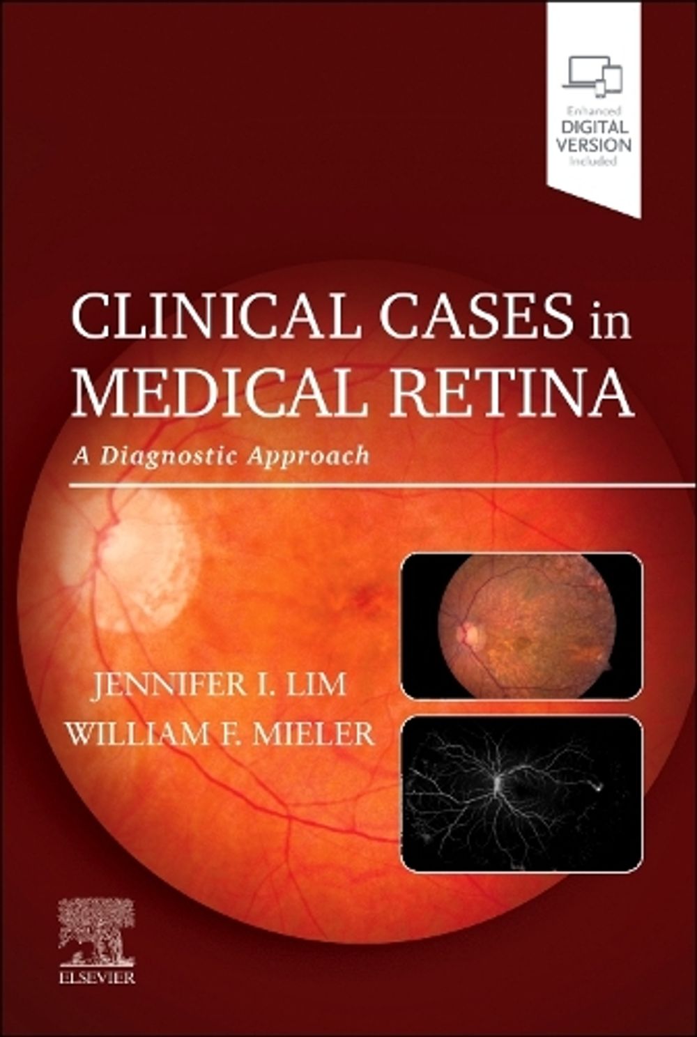 Clinical Cases in Medical Retina by Jennifer I. Lim - ISBN: 9780128227206