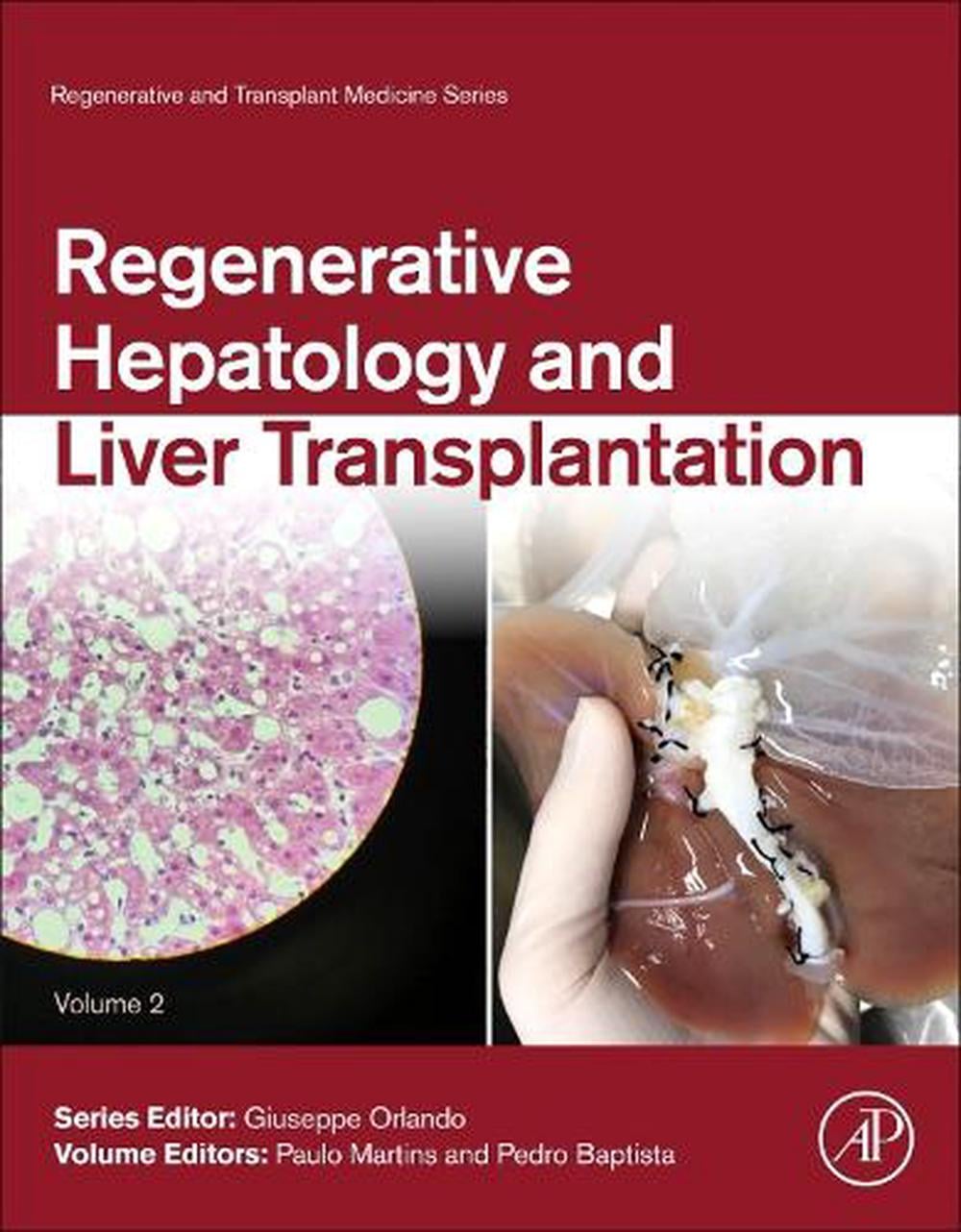 Regenerative Hepatology and Liver Transplantation by Paulo Martins - ISBN: 9780128235249