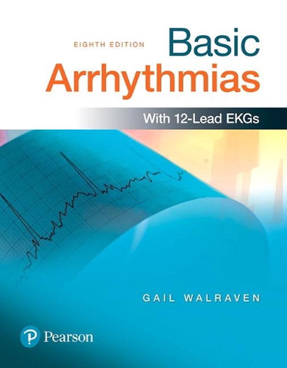 Basic Arrhythmias, 9780134380995