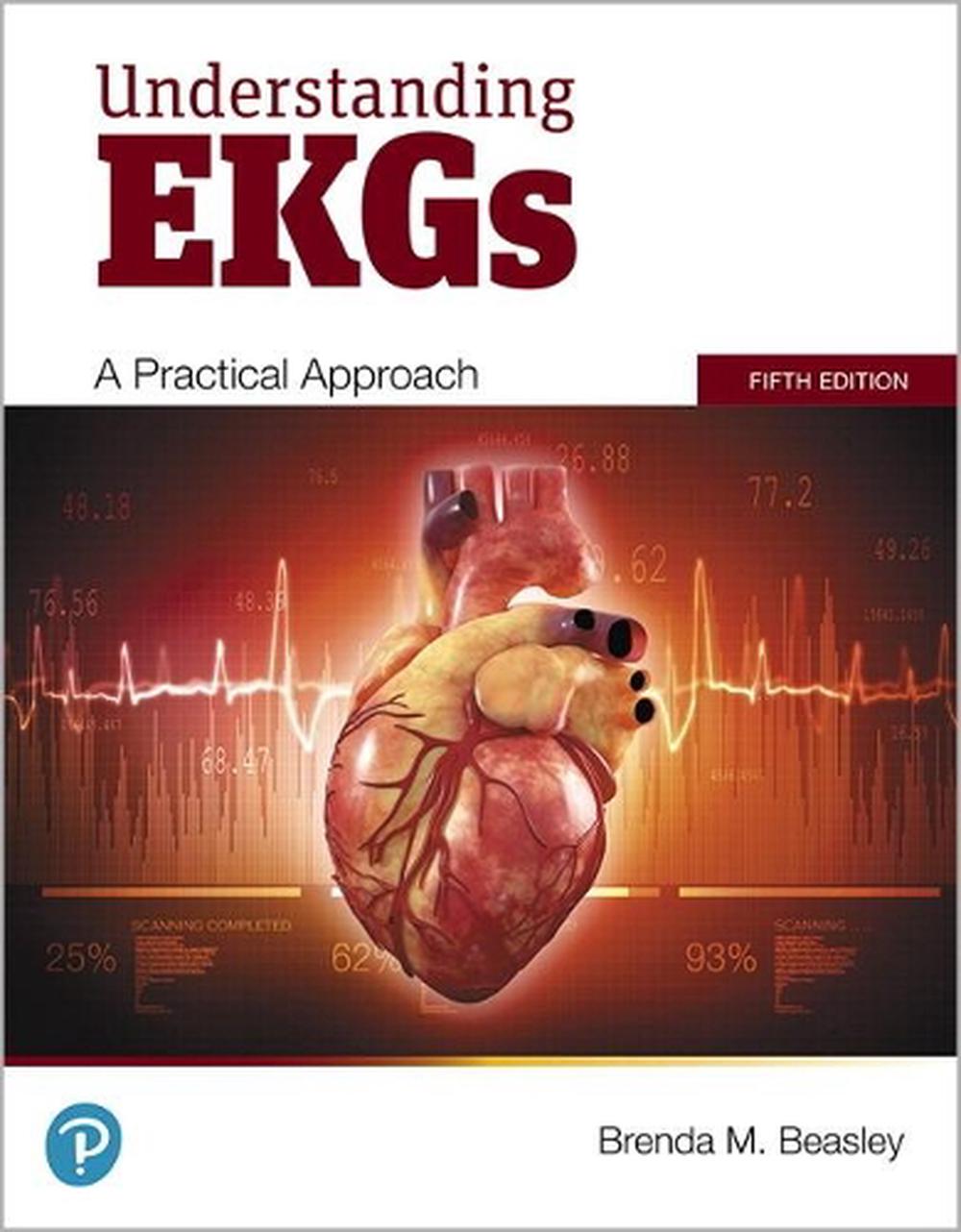 Understanding EKGs, 9780135213414