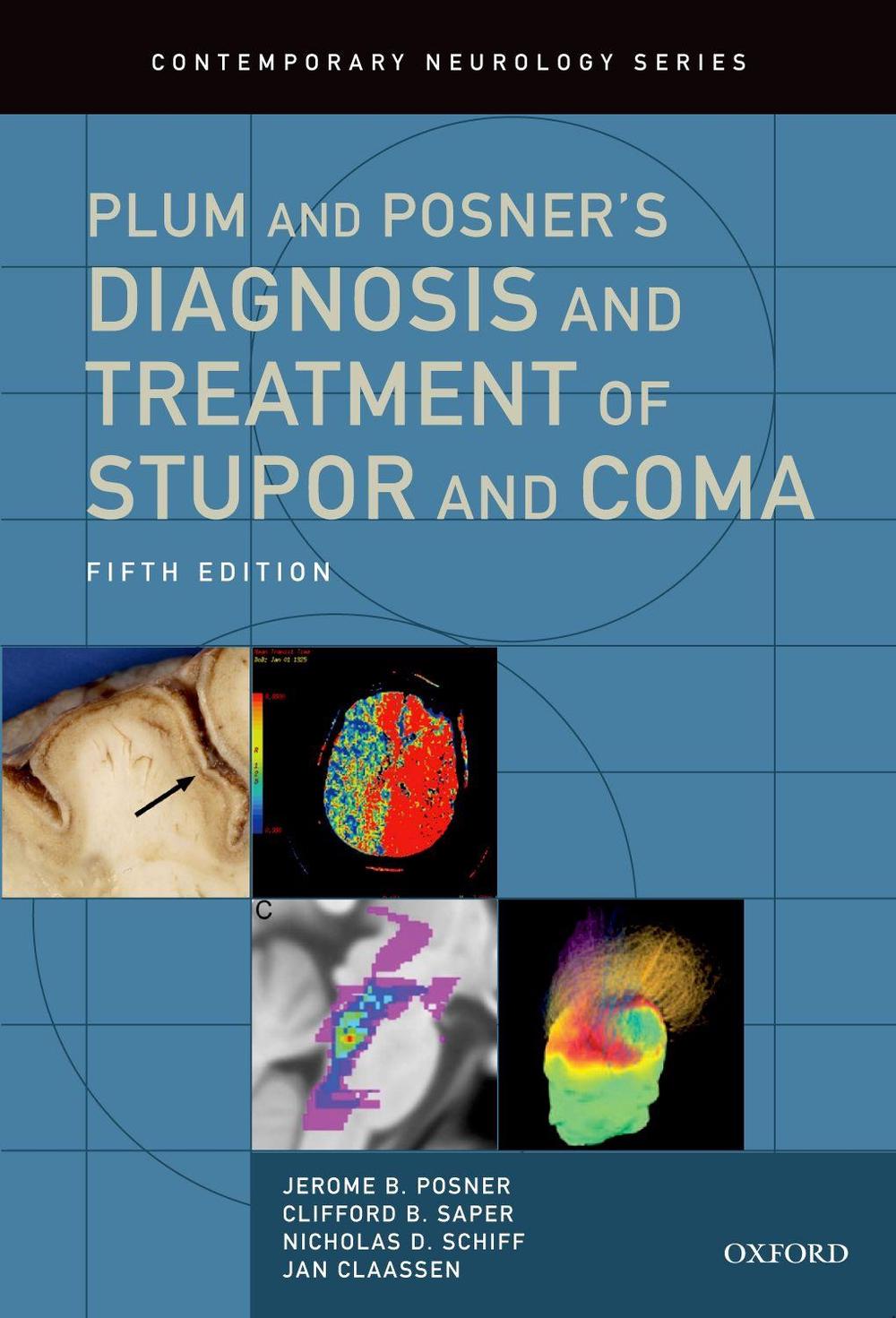Plum and Posner's Diagnosis and Treatment of Stupor and Coma, 9780190208875