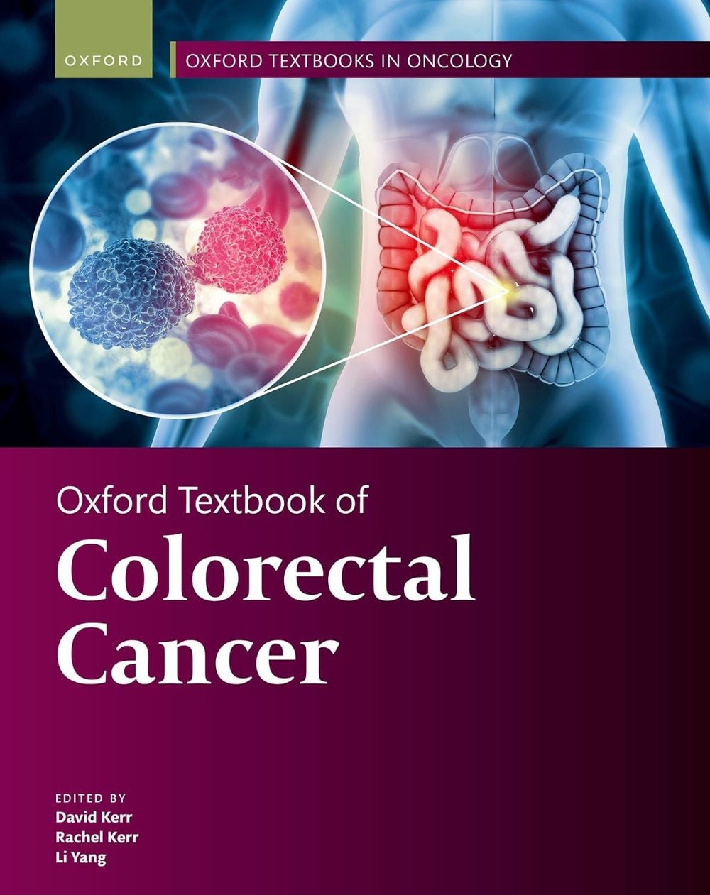 Oxford Textbook of Colorectal Cancer by Rachel Kerr - ISBN: 9780192849991