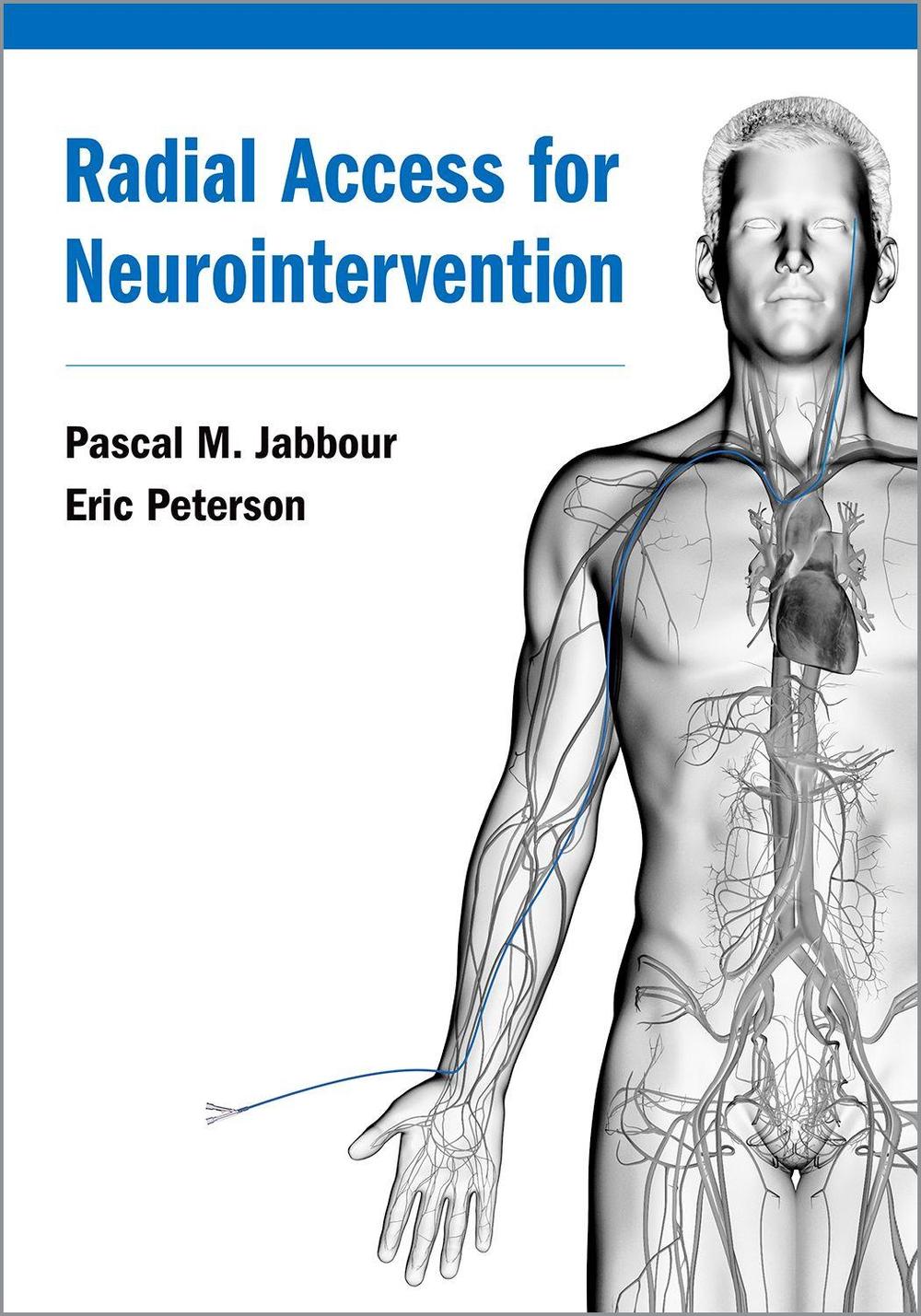 Radial Access for Neurointervention, 9780197524176