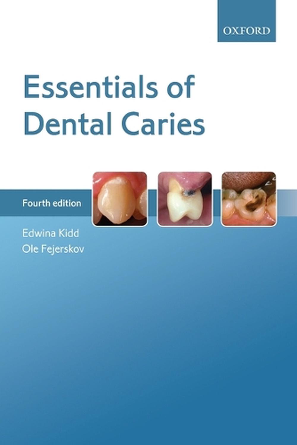 Essentials of Dental Caries, 4th Edition, 9780198738268