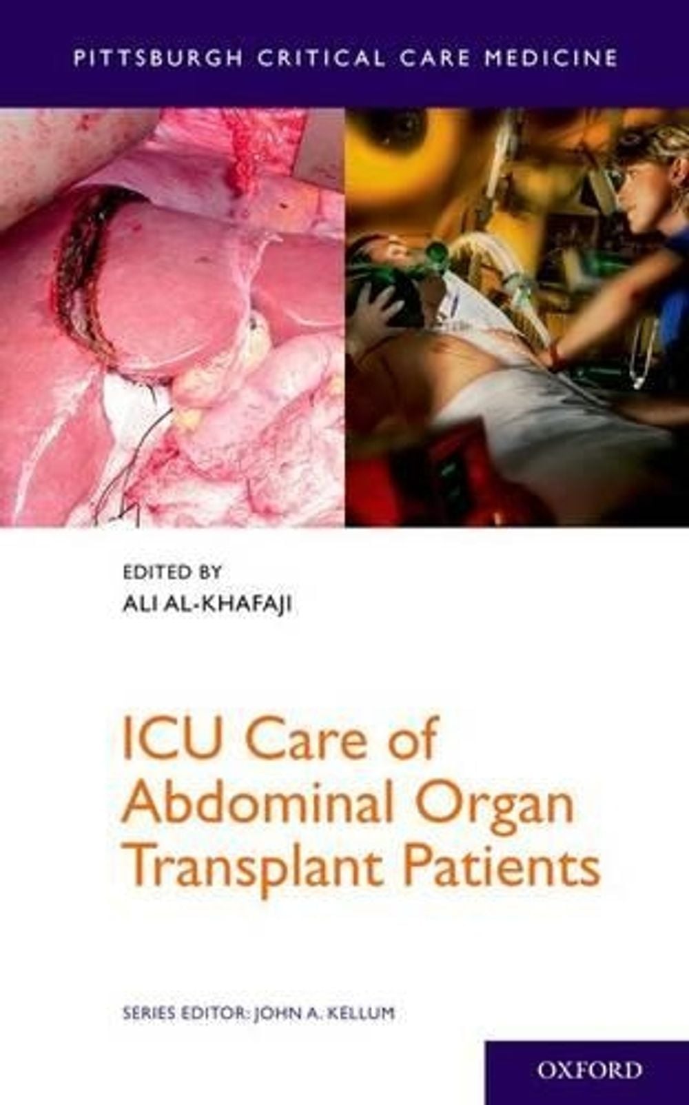 ICU Care of Abdominal Organ Transplant Patients by Ali Al-Khafaji - ISBN: 9780199768899