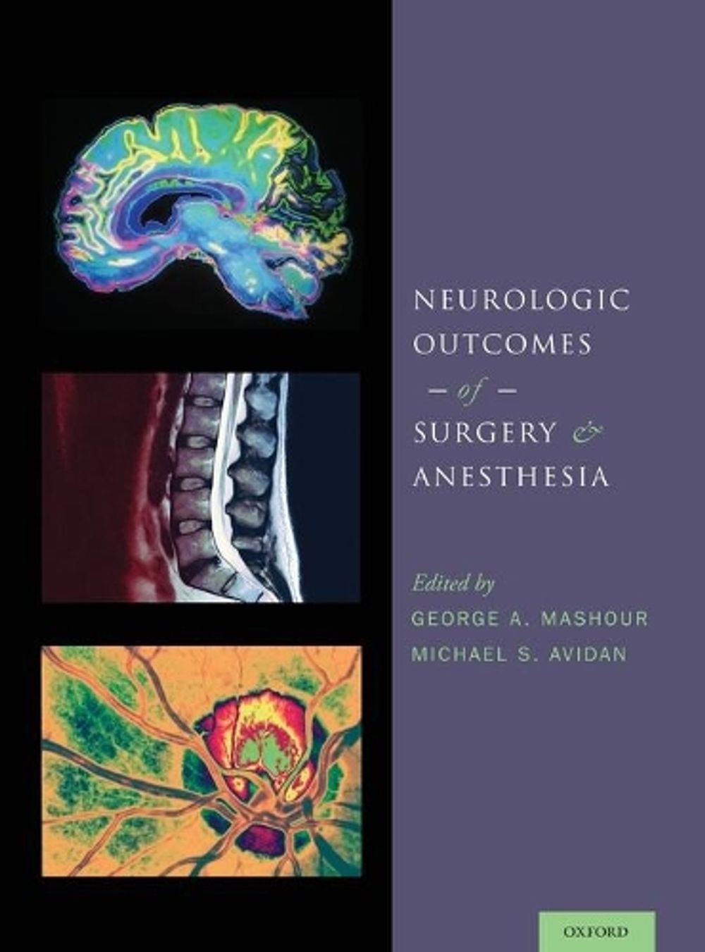 Neurologic Outcomes of Surgery and Anesthesia by George A. Mashour - ISBN: 9780199895724