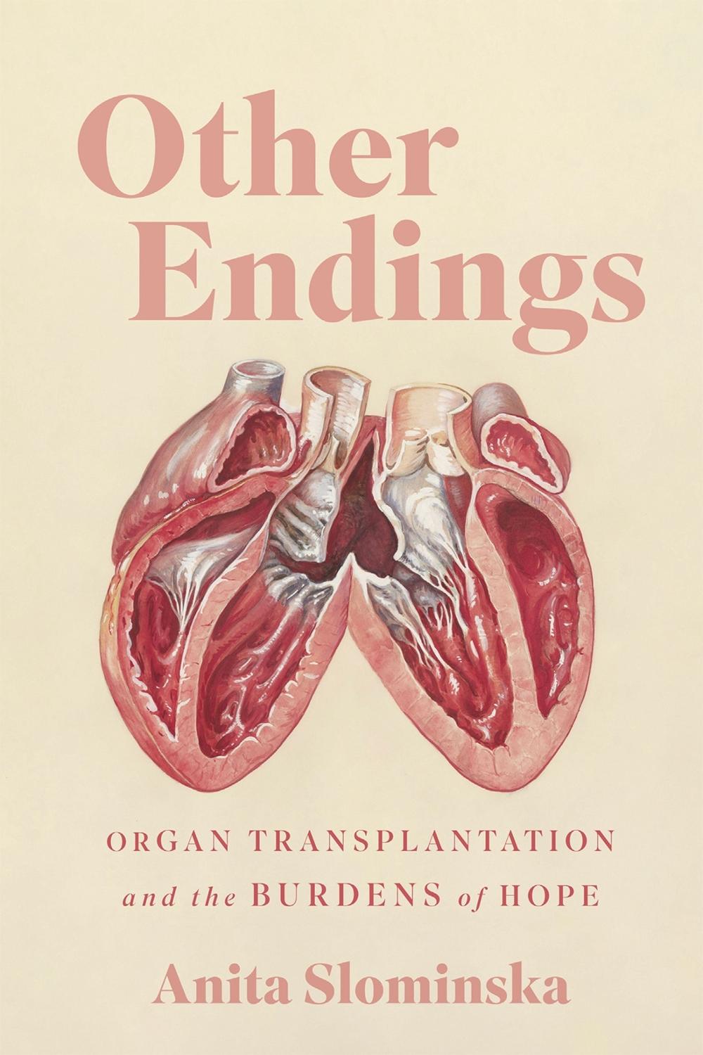 Other Endings by Anita Slominska - ISBN: 9780228027195