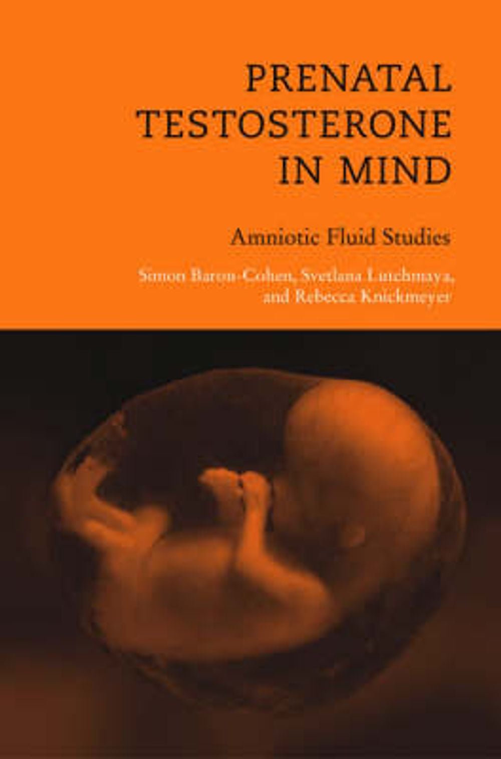 Prenatal Testosterone in Mind: Amniotic Fluid Studies by Simon Baron-Cohen - ISBN: 9780262524568