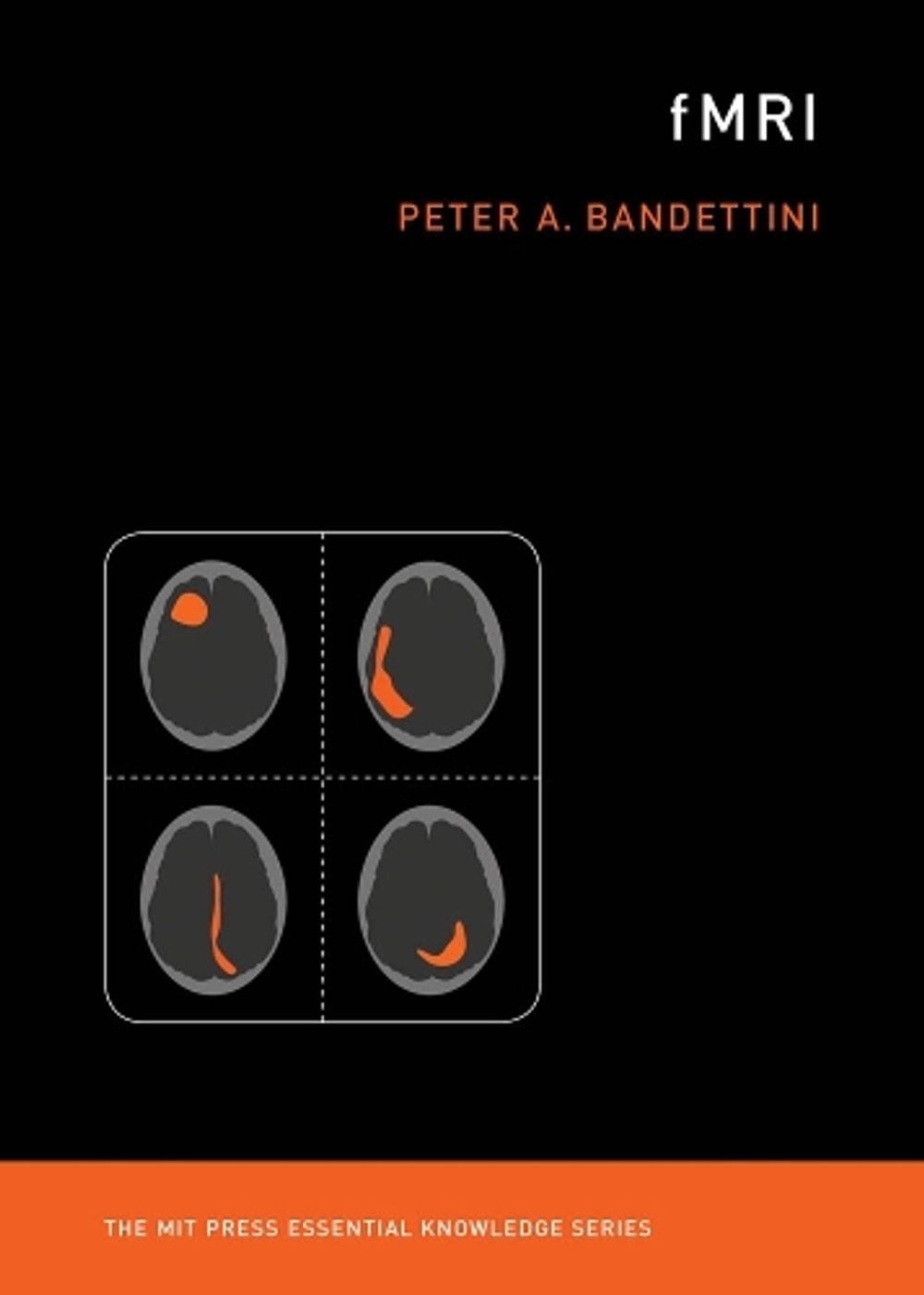 fMRI by Peter A. Bandettini - ISBN: 9780262538039