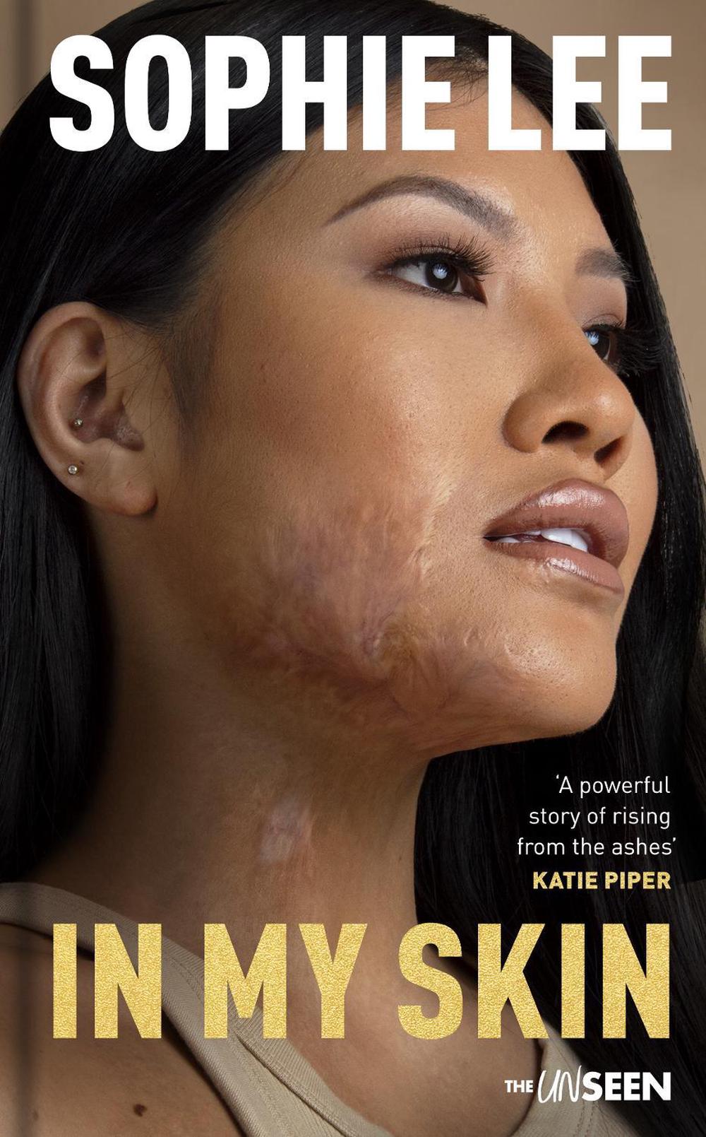 In My Skin by Sophie Lee - ISBN: 9780281089406