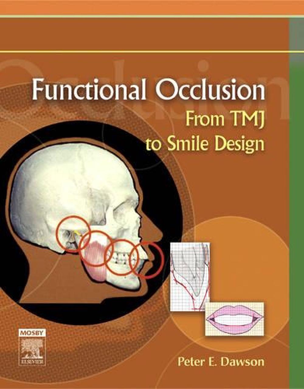 Functional Occlusion, 1st Edition, 9780323033718