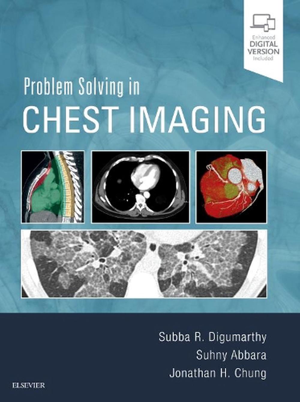 Problem Solving in Chest Imaging, 9780323041324