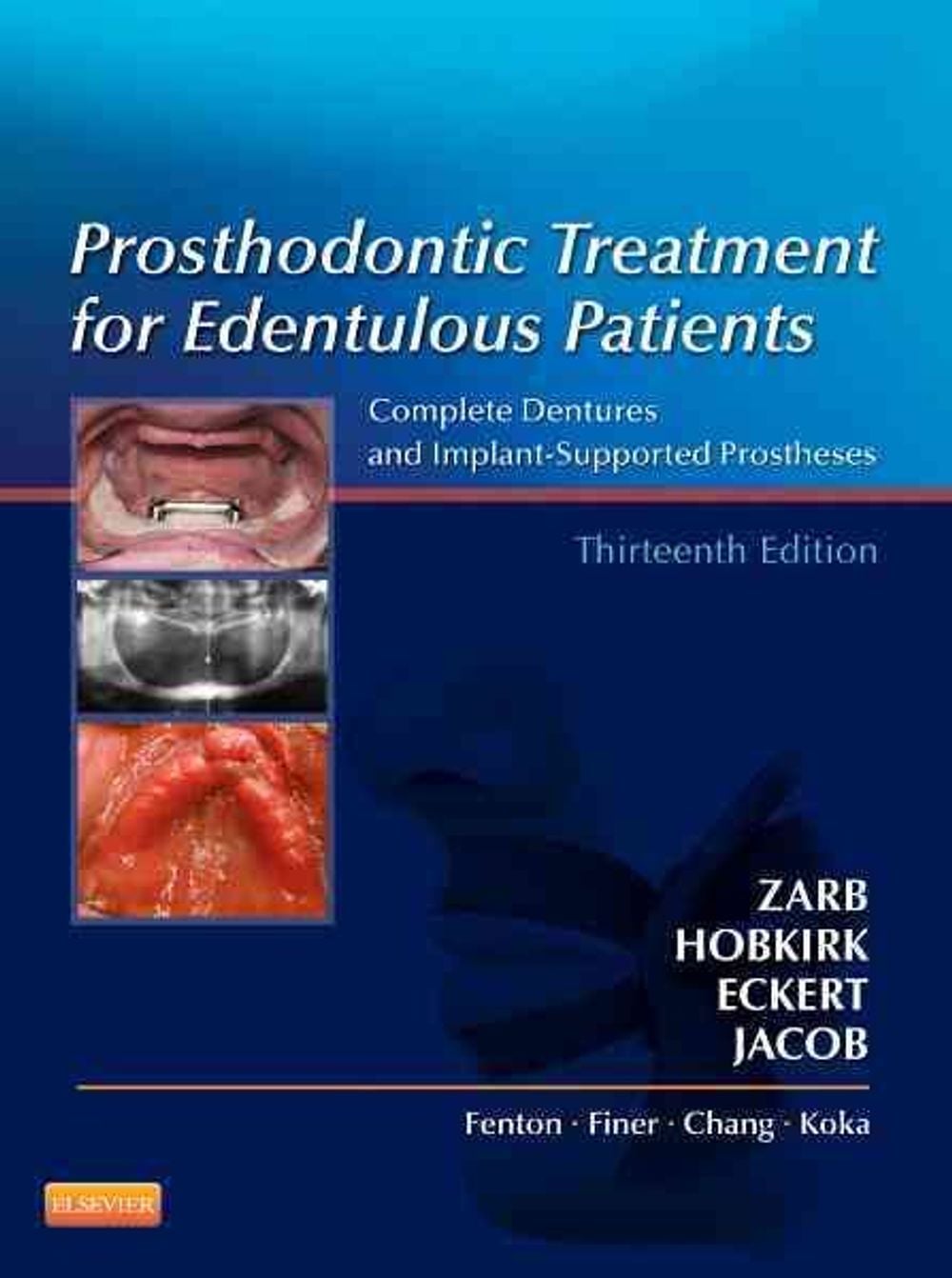 Prosthodontic Treatment for Edentulous Patients, 13th Edition by George A. Zarb - ISBN: 9780323078443