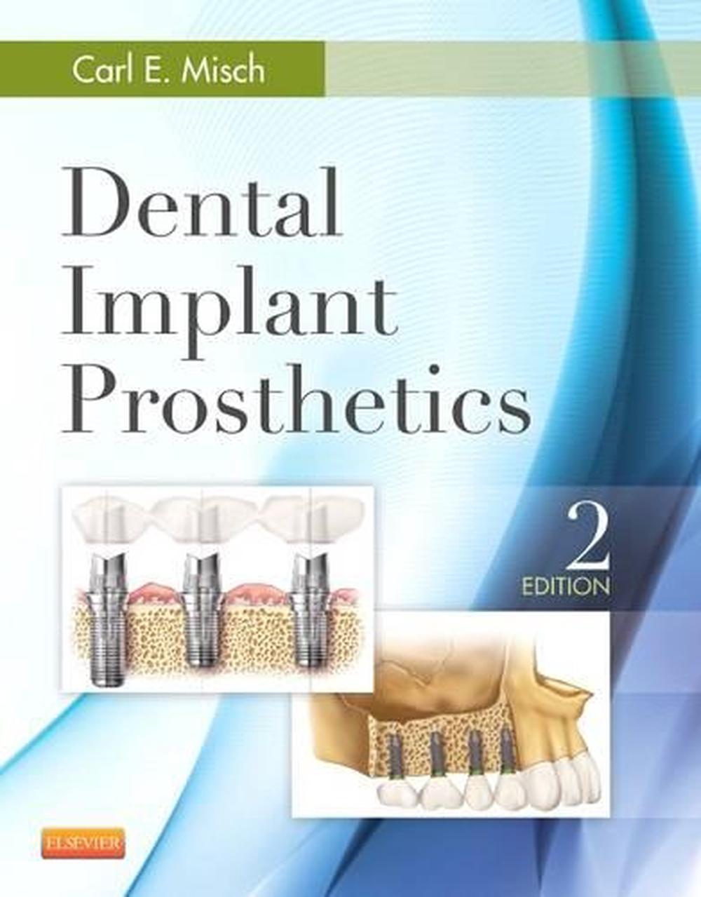 Dental Implant Prosthetics, 2nd Edition, 9780323078450