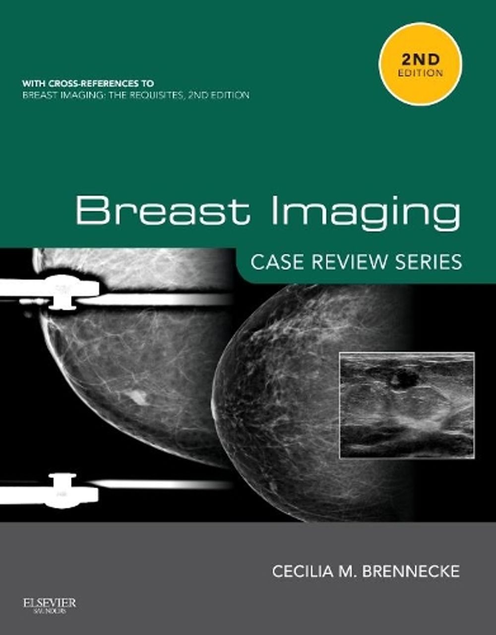 Breast Imaging: Case Review Series, 2nd Edition by Cecilia M. Brennecke - ISBN: 9780323087223