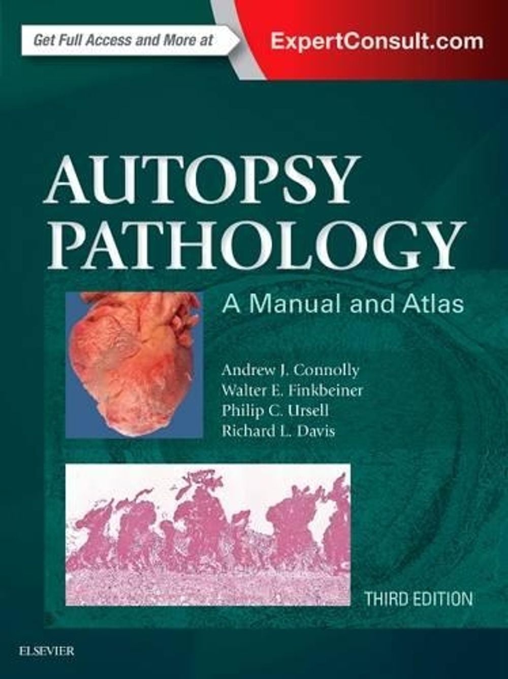 Autopsy Pathology: A Manual and Atlas, 3rd Edition by Walter E. Finkbeiner - ISBN: 9780323287807