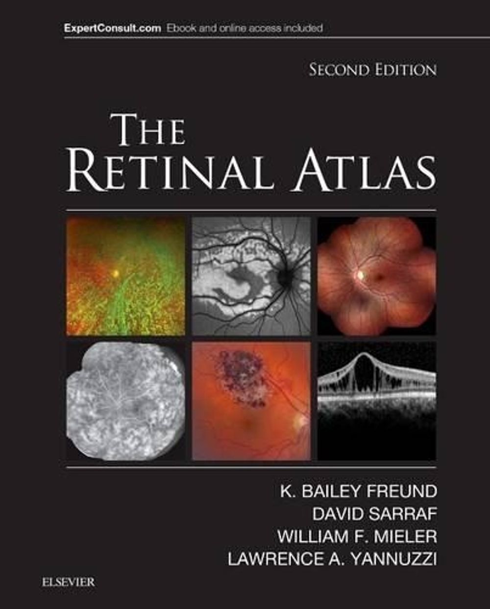 The Retinal Atlas, 2nd Edition by David Sarraf - ISBN: 9780323287920