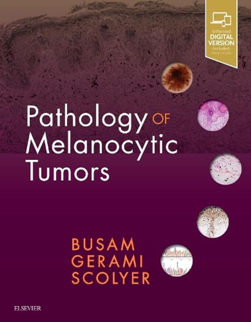 Pathology of Melanocytic Tumors by Pedram Gerami - ISBN: 9780323374576