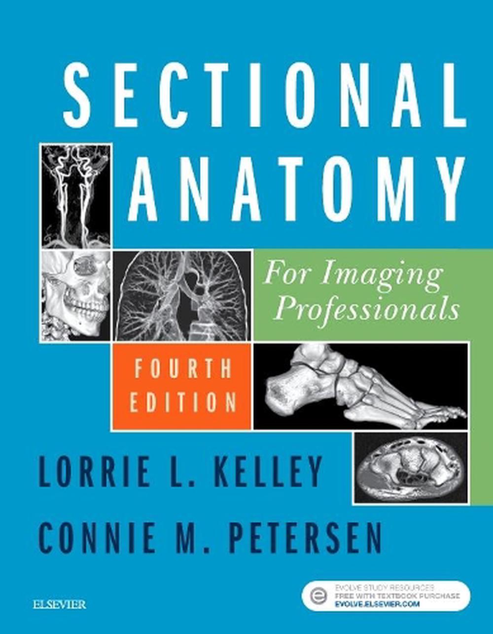 Sectional Anatomy for Imaging Professionals, 9780323414876