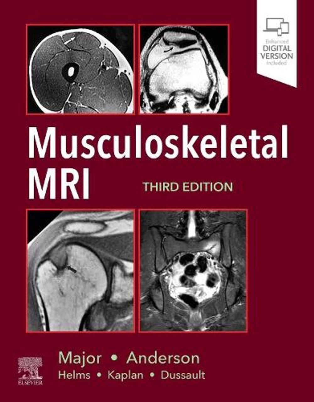 Musculoskeletal MRI, 3rd Edition by Nancy M. Major - ISBN: 9780323415606