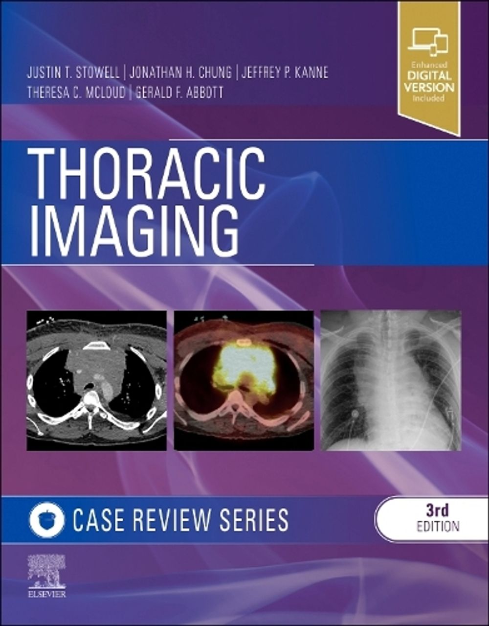 Thoracic Imaging: Case Review, 3rd Edition by Gerald F. Abbott - ISBN: 9780323428798