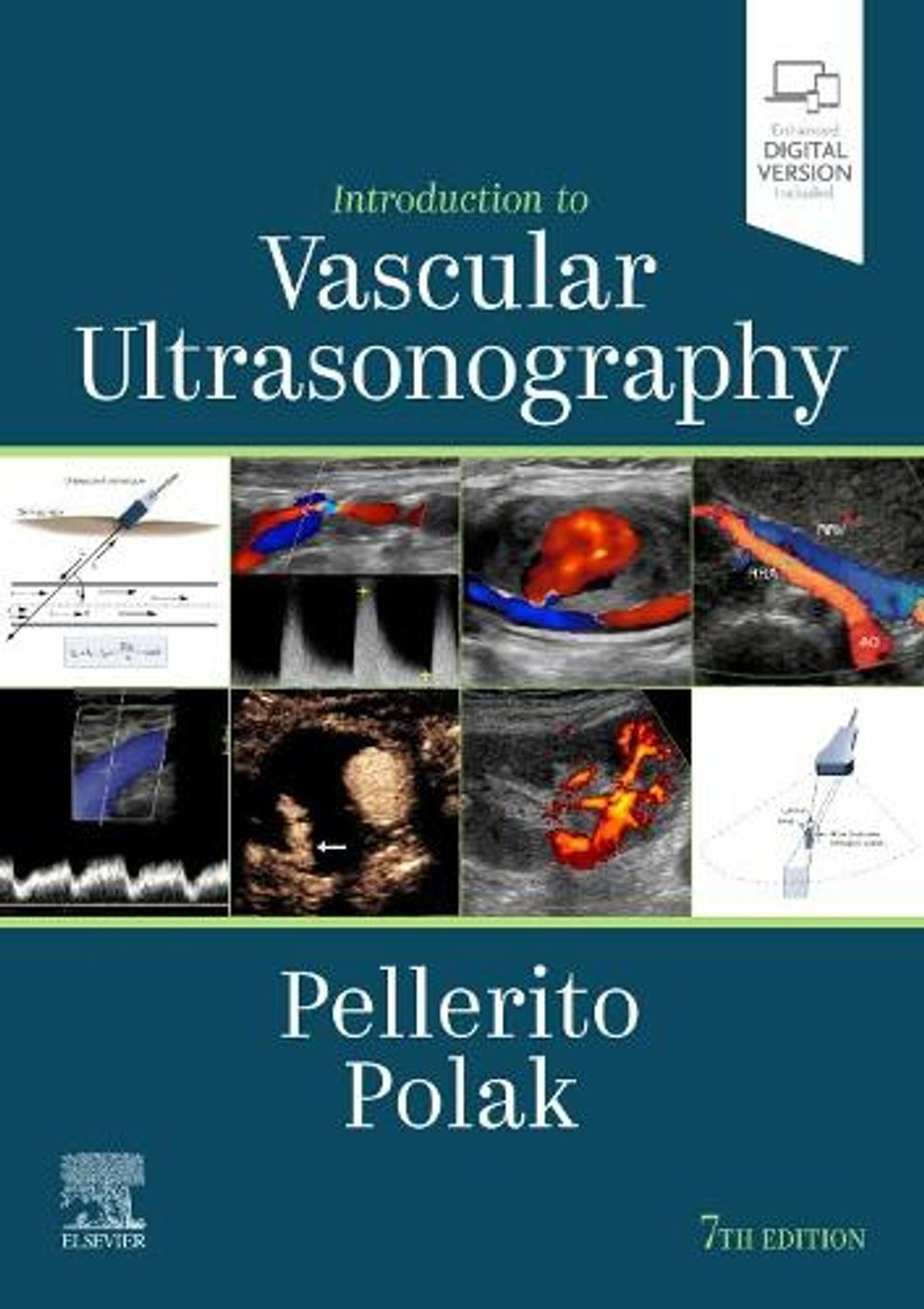 Introduction to Vascular Ultrasonography, 7th Edition by Joseph F. Polak - ISBN: 9780323428828