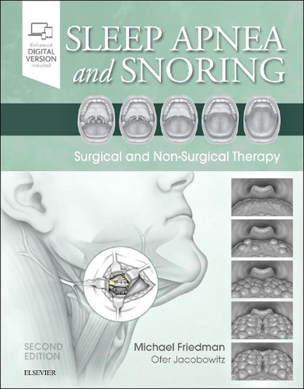 Sleep Apnea and Snoring, 2nd Edition, 9780323443395