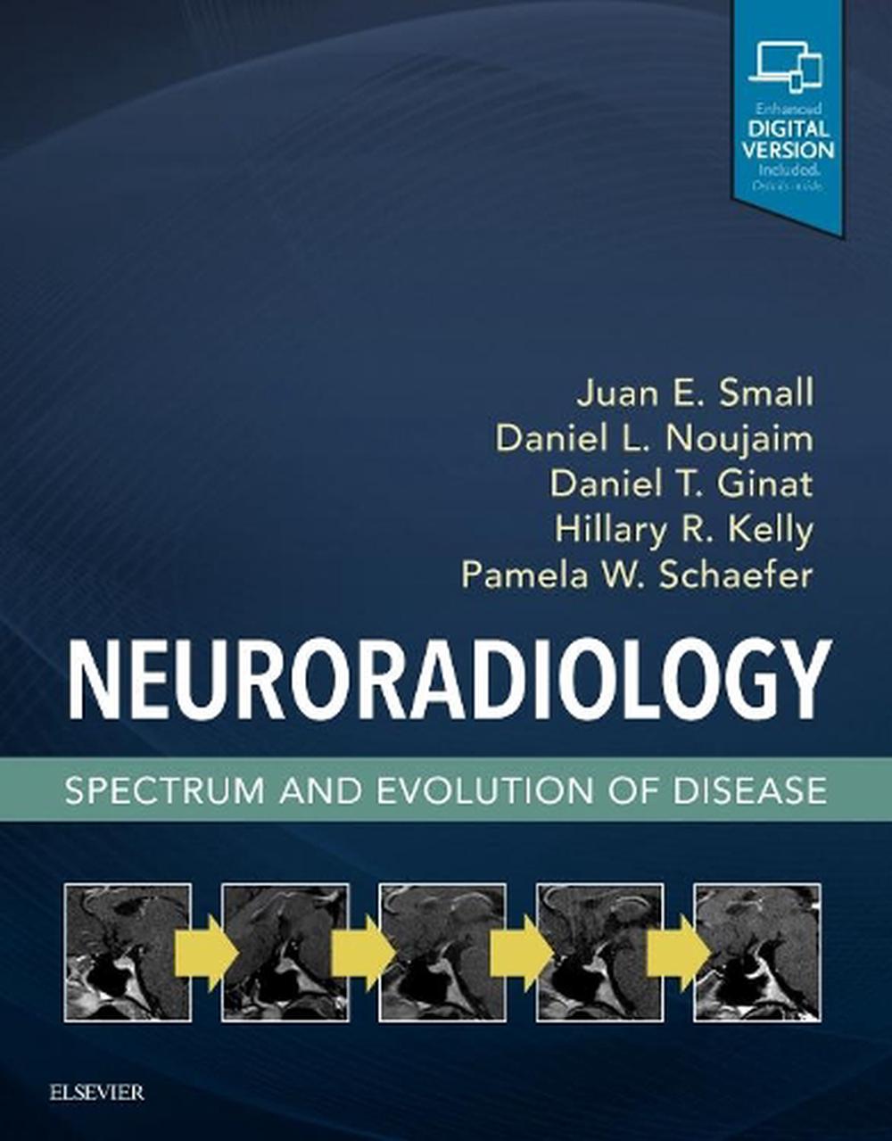 Neuroradiology: Spectrum and Evolution of Disease, 9780323445498