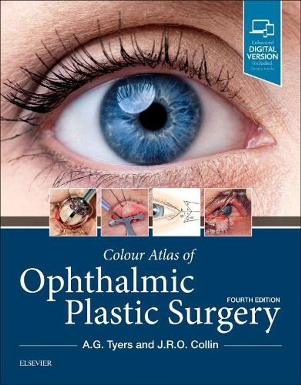Colour Atlas of Ophthalmic Plastic Surgery, 4th Edition by J.R.O. Collin - ISBN: 9780323476799