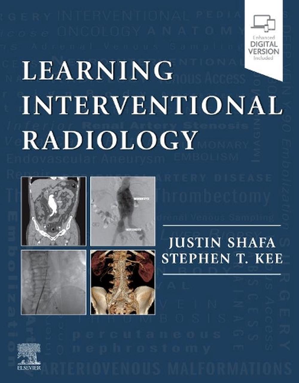 Learning Interventional Radiology, 1st Edition, 9780323478793