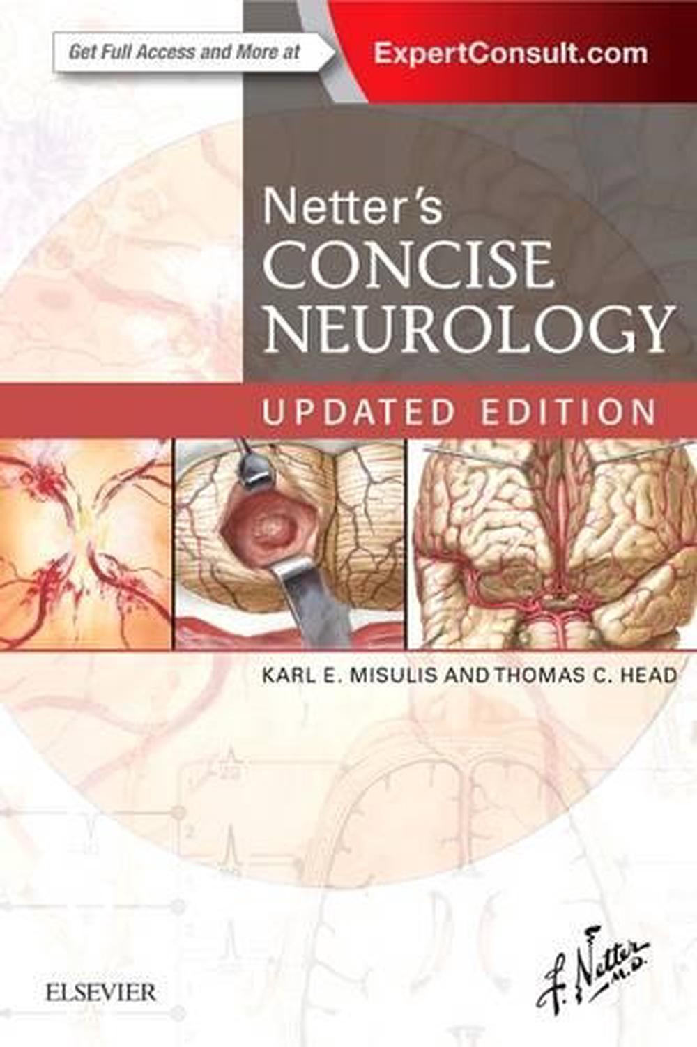 Netter's Concise Neurology Updated Edition, 9780323482547