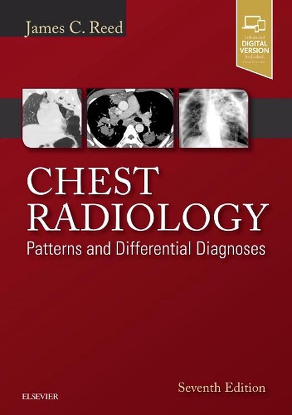 Chest Radiology, 7th Edition, 9780323498319