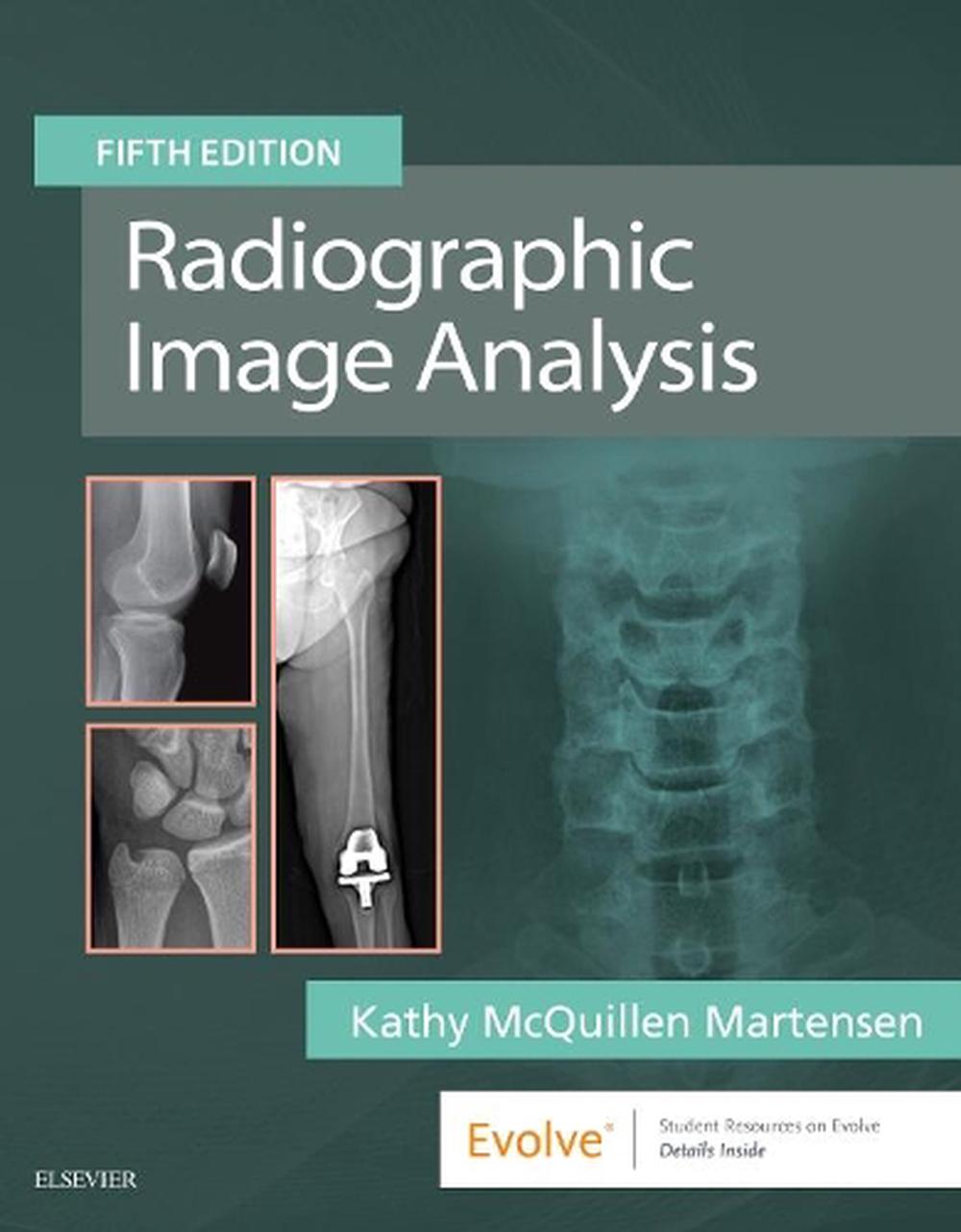 radiographic-image-analysis-5th-edition-by-kathy-mcquillen-martensen