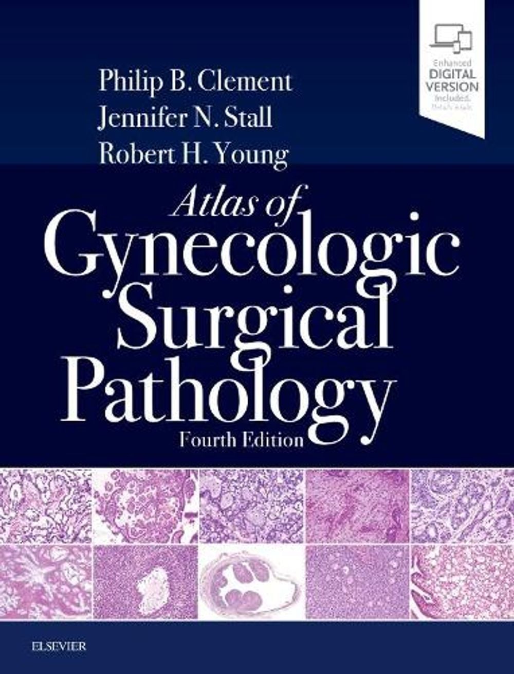 Atlas of Gynecologic Surgical Pathology, 4th Edition by Philip B. Clement - ISBN: 9780323528009