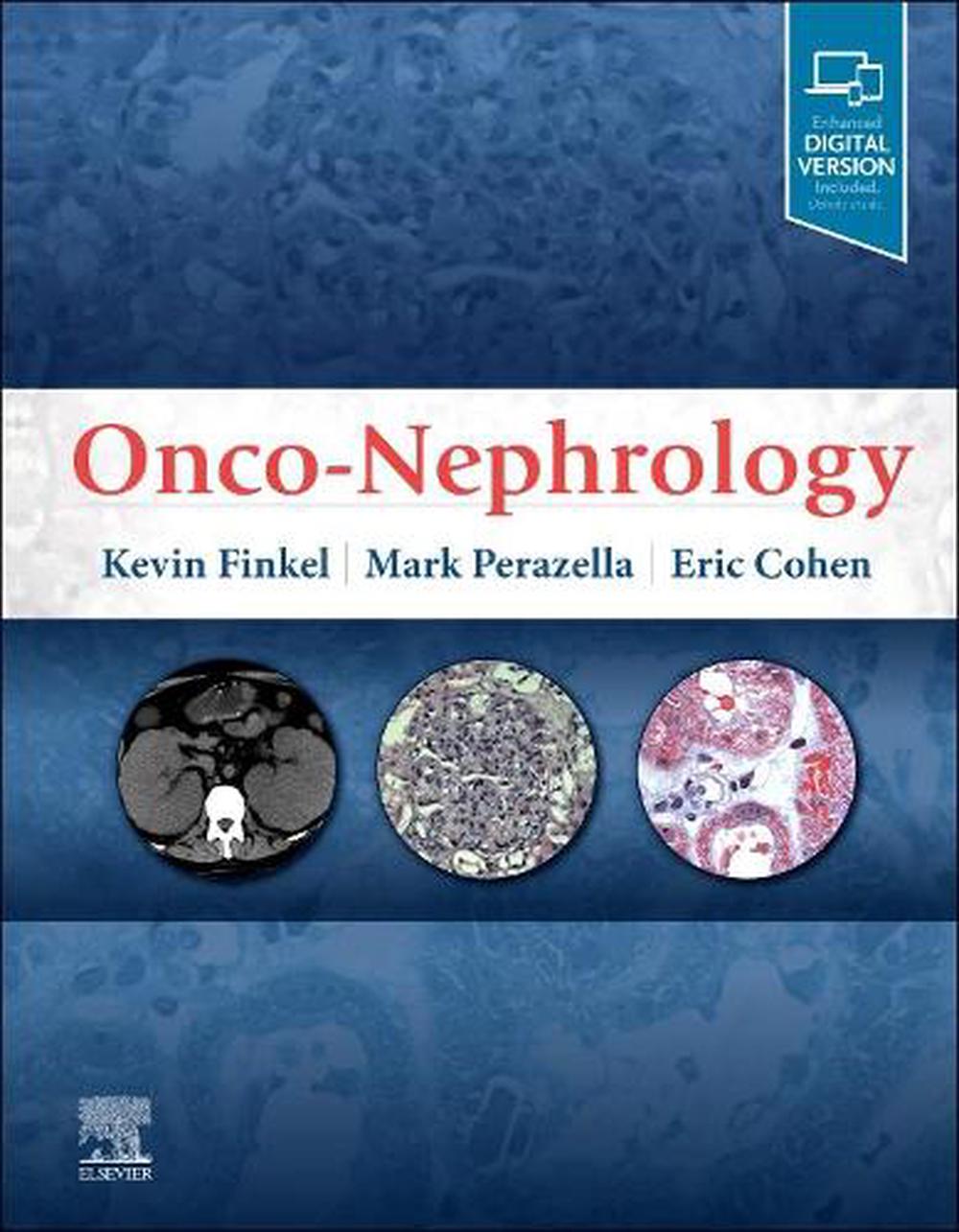 Onco-Nephrology, 9780323549455