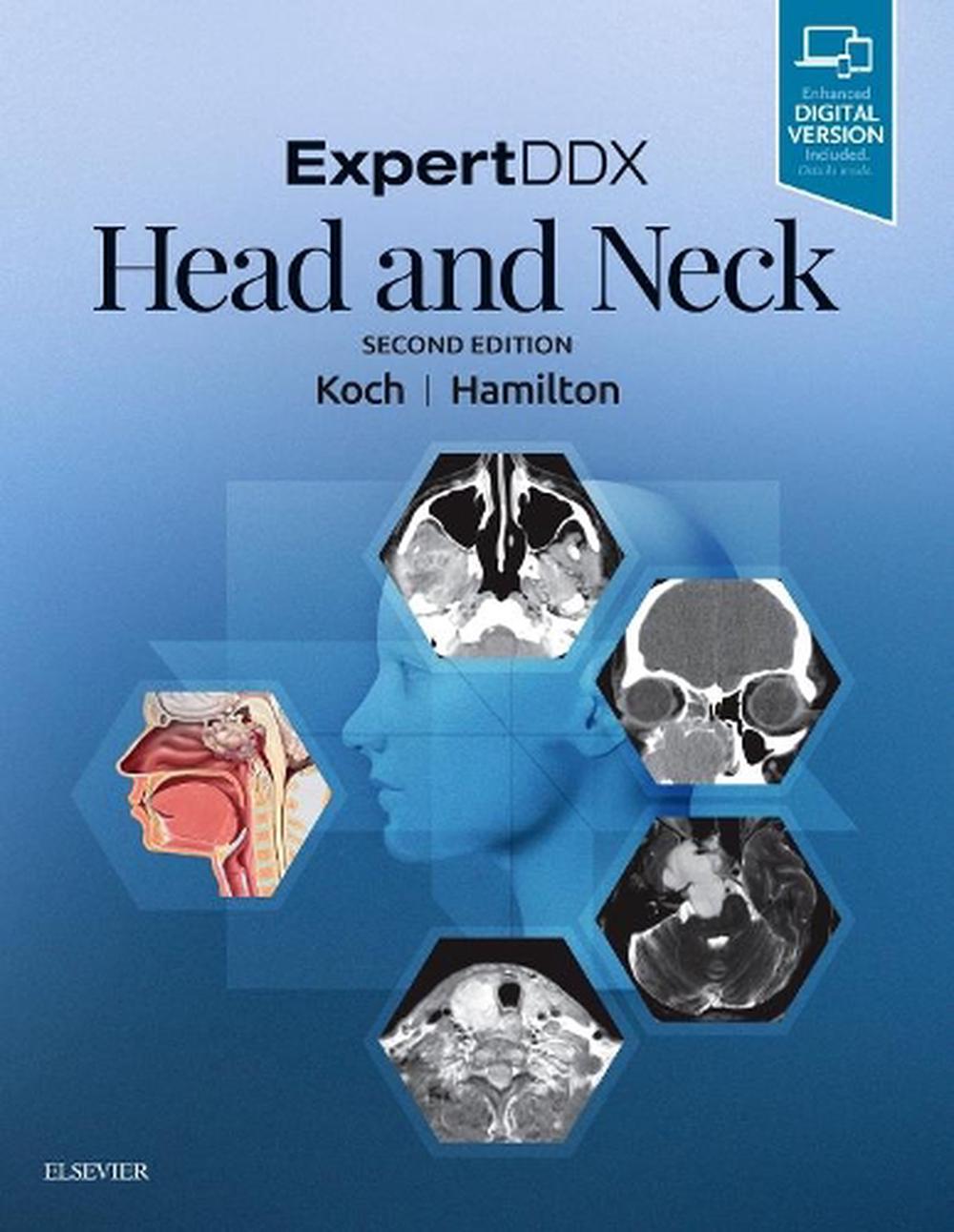 ExpertDDX: Head and Neck, 2nd Edition, 9780323554053