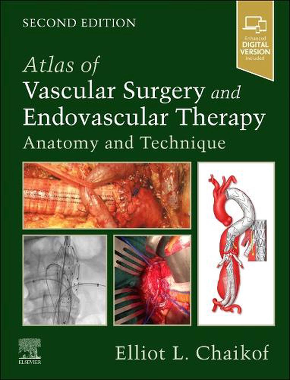 Atlas of Vascular Surgery and Endovascular Therapy, 9780323566940