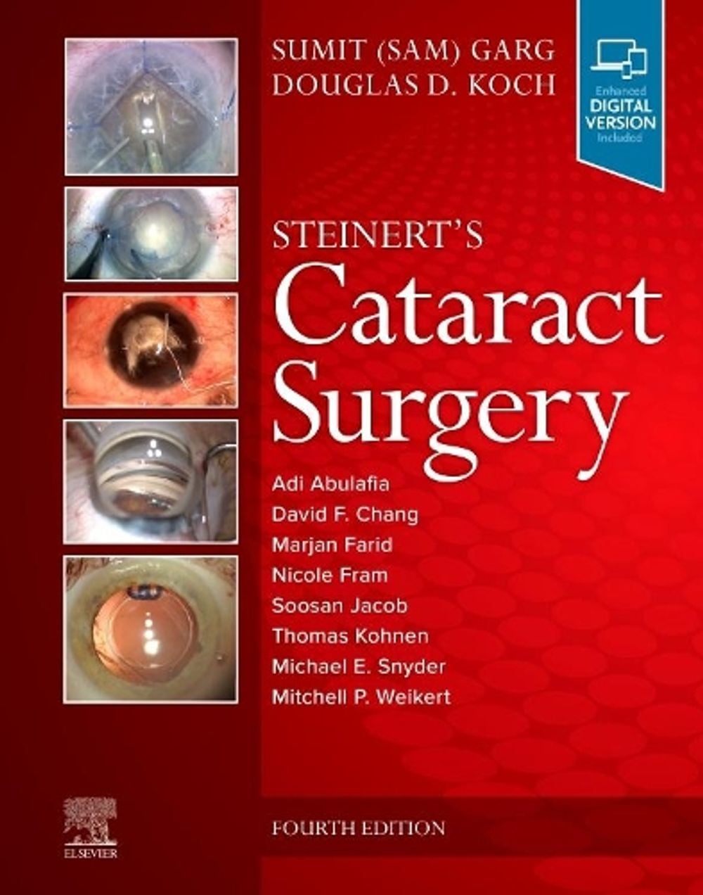 Steinert's Cataract Surgery, 4th Edition by Sumit Garg - ISBN: 9780323568111