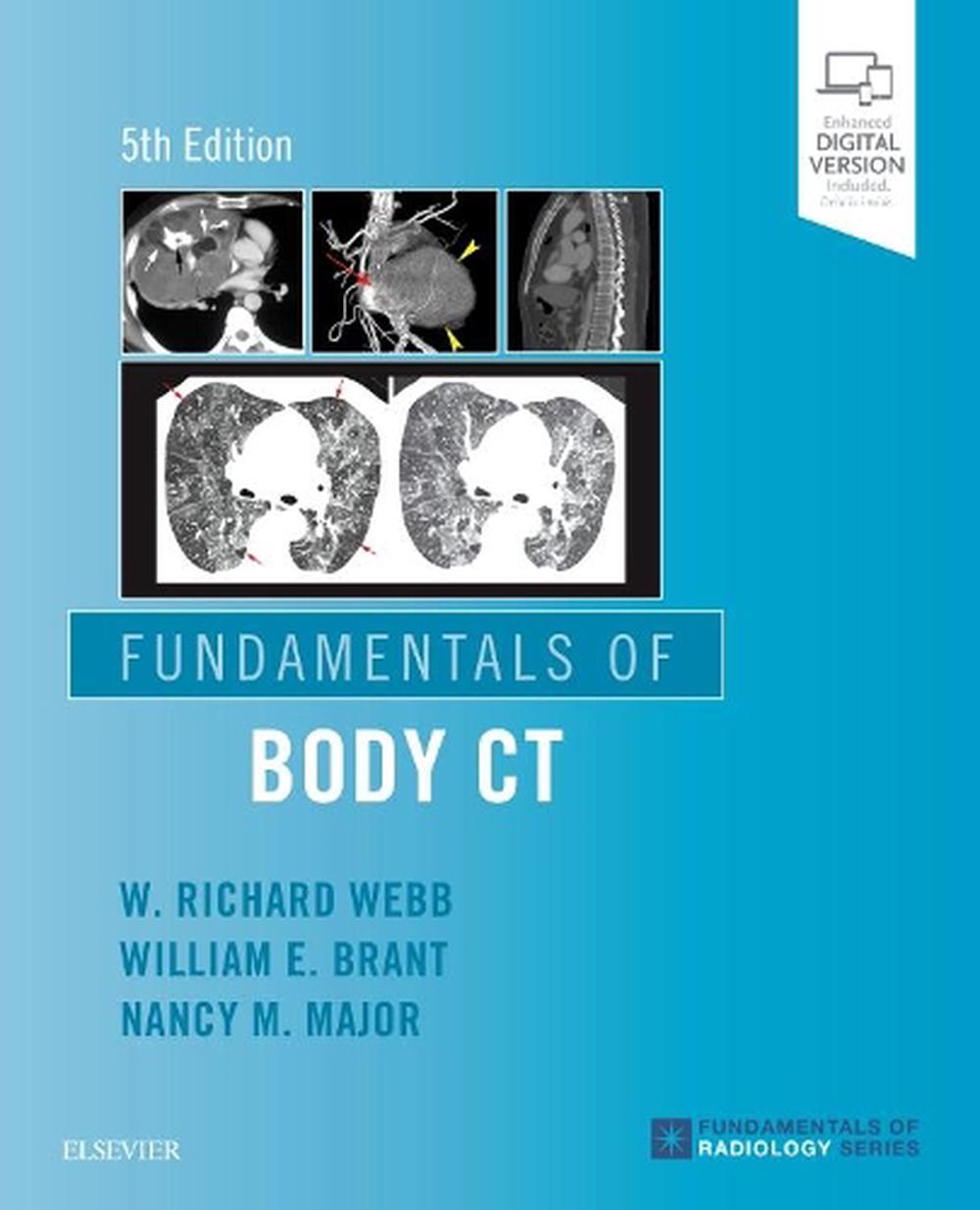 Fundamentals of Body CT, 5th Edition, 9780323608329