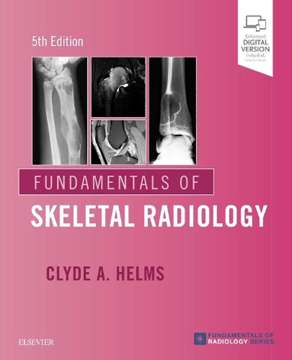 Fundamentals of Skeletal Radiology, 5th Edition, 9780323611657