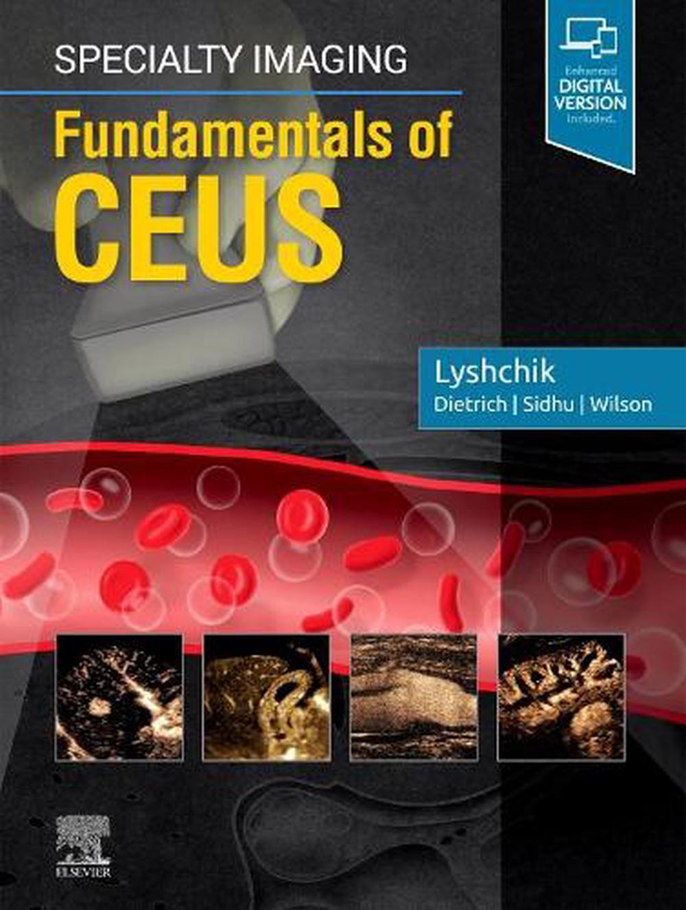 Specialty Imaging: Fundamentals of CEUS, 9780323625647