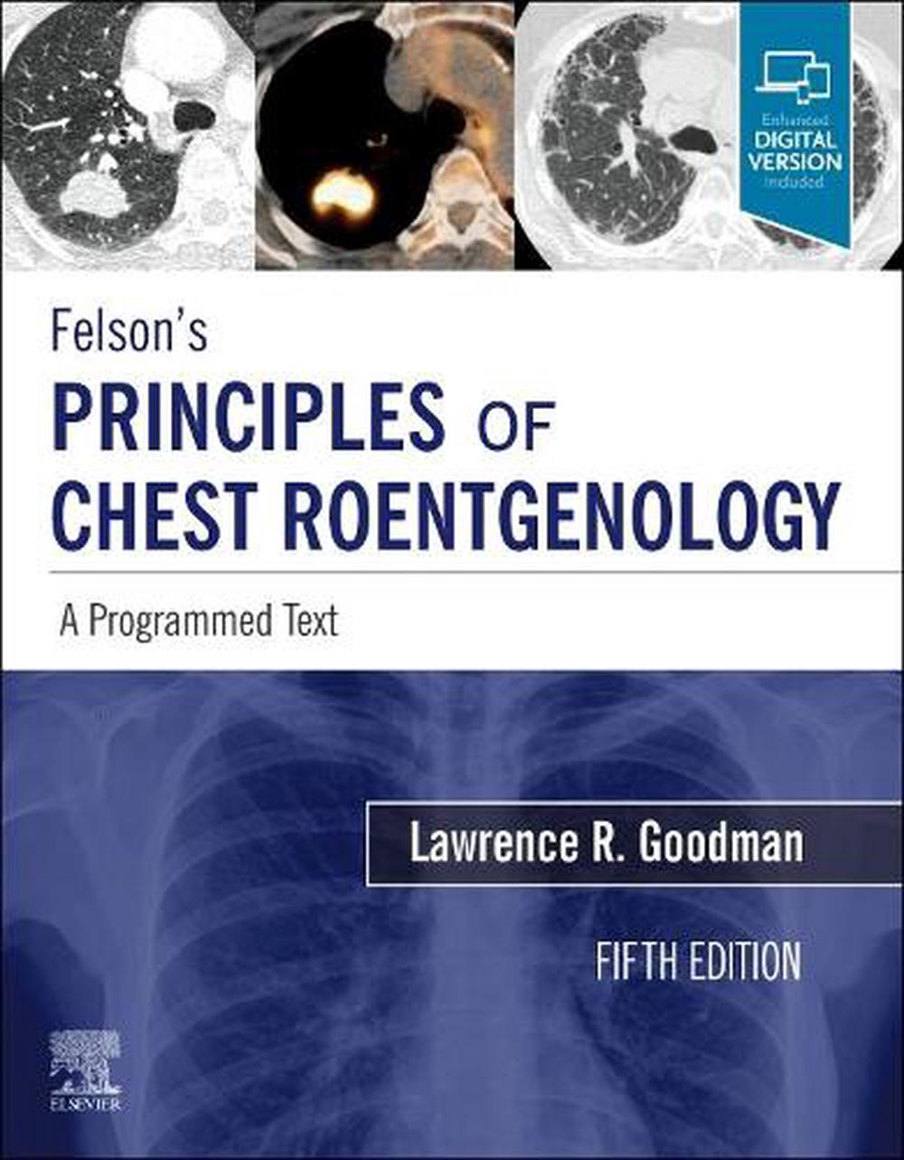 Felson's Principles of Chest Roentgenology, A Programmed Text, 5th Edition, 9780323625678