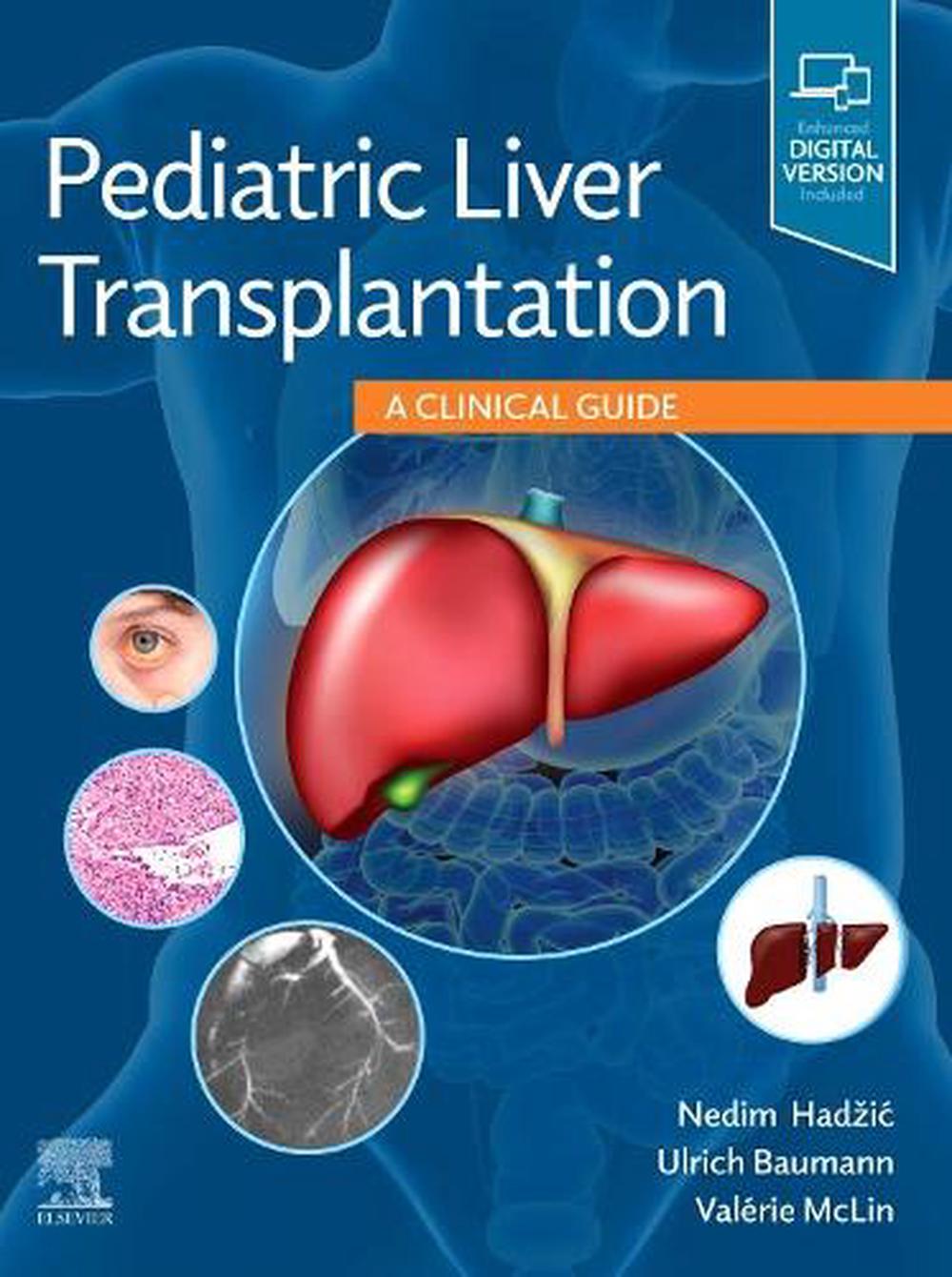 Pediatric Liver Transplantation, 9780323636711